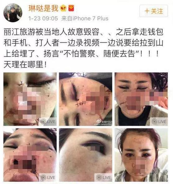 丽江毁容事件深度探究与反思，反思背后的社会问题与应对之道